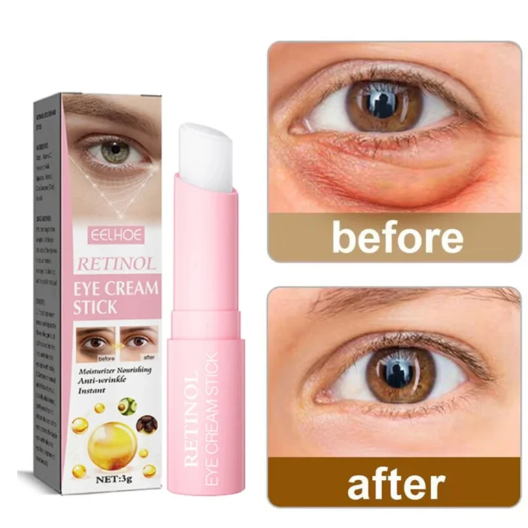 Dark Circles Eye Bags Remover