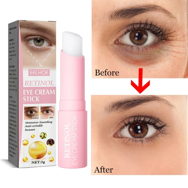 Dark Circles Eye Bags Remover